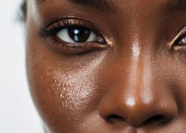 Oily Skin